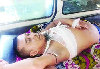 গোপালগঞ্জের মুকসুদপুরে স্থানীয় প্রভাব বিস্তার নিয়ে হামলা আহত-২ থানায় মামলা দায়ের